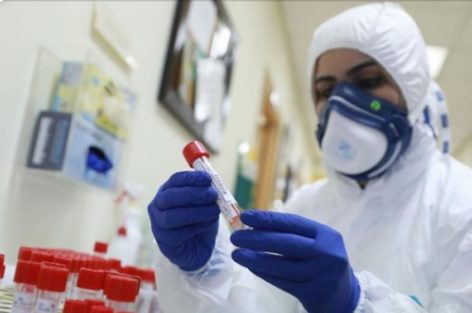 منظمة الصحة العالمية تدعو إلى زيادة اختبار فيروس كورونا
